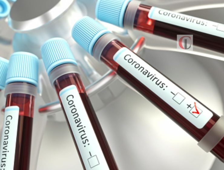 COVID-19 vaccine produce antibodies in Guinea pigs, mice; says Inovio